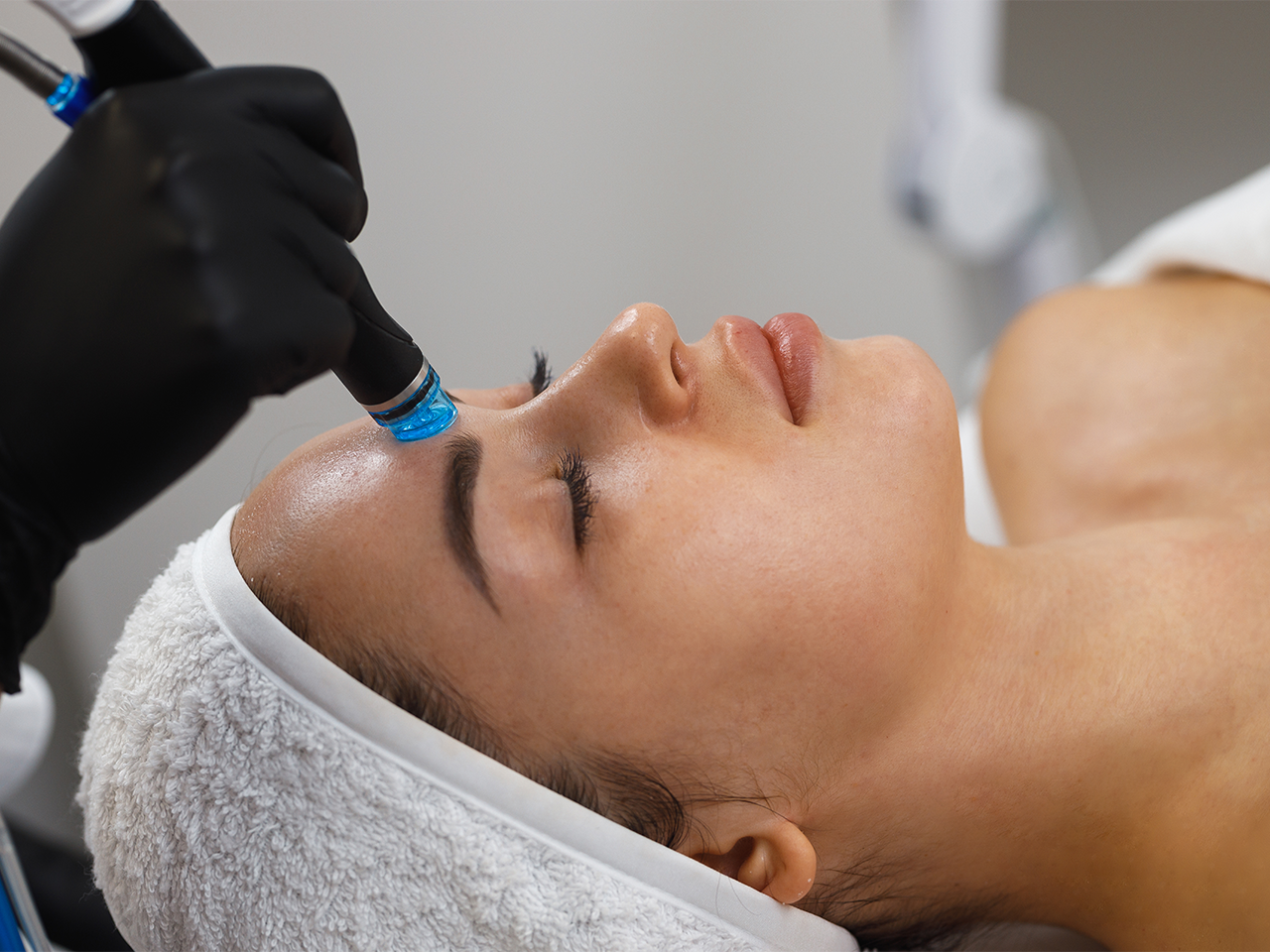 dermapen